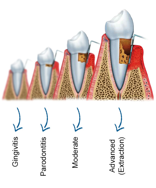 Parodontologie casablanca